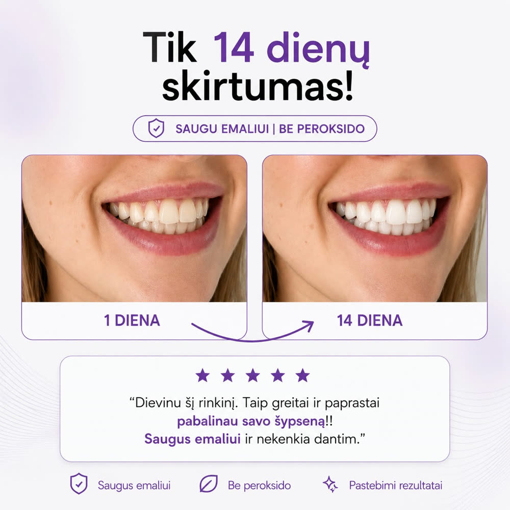 1 diena prieš 14 dieną